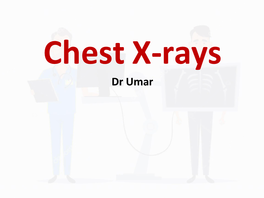 Chest X-Rays Dr Umar Radiographic Densities
