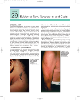 29 Epidermal Nevi, Neoplasms, and Cysts