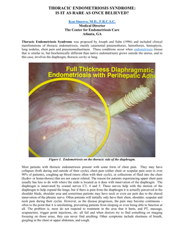 Thoracic Endometriosis Syndrome: Is It As Rare As Once Believed?