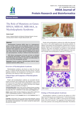 The Role of Mutations on Genes RPS14, MIR145, MIR146A, in Myelodysplastic Syndrome