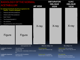 Acetabular Teaching Module