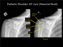 Pediatric Shoulder AP View (Humeral Head)