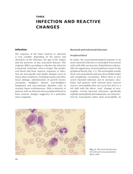 Infection and Reactive Changes
