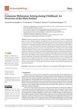 Cutaneous Melanomas Arising During Childhood: an Overview of the Main Entities