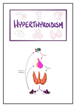 Hyperthyroidism Treatment