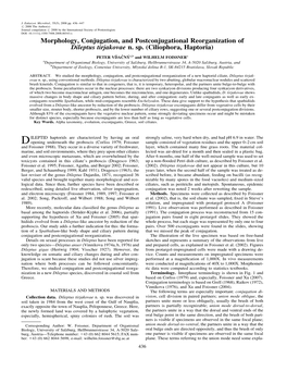 Morphology, Conjugation, and Postconjugational Reorganization of Dileptus Tirjakovae N