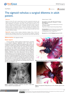 The Sigmoid Volvulus: a Surgical Dilemma in Adult Patient