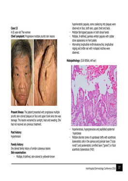 Interhospital Dermatology Conference 2016 Case 13 a 65 Year-Old Thai