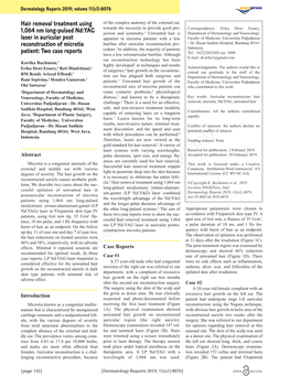 Hair Removal Treatment Using 1064 Nm Long-Pulsed Nd: YAG Laser in Auricular Post Reconstruction of Microtia Patient: Two Case Reports