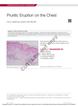 Pruritic Eruption on the Chest