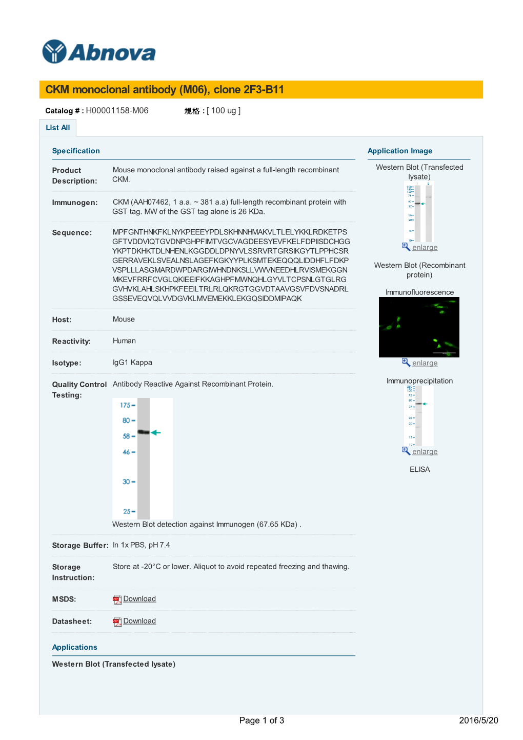 CKM Monoclonal Antibody (M06), Clone 2F3-B11