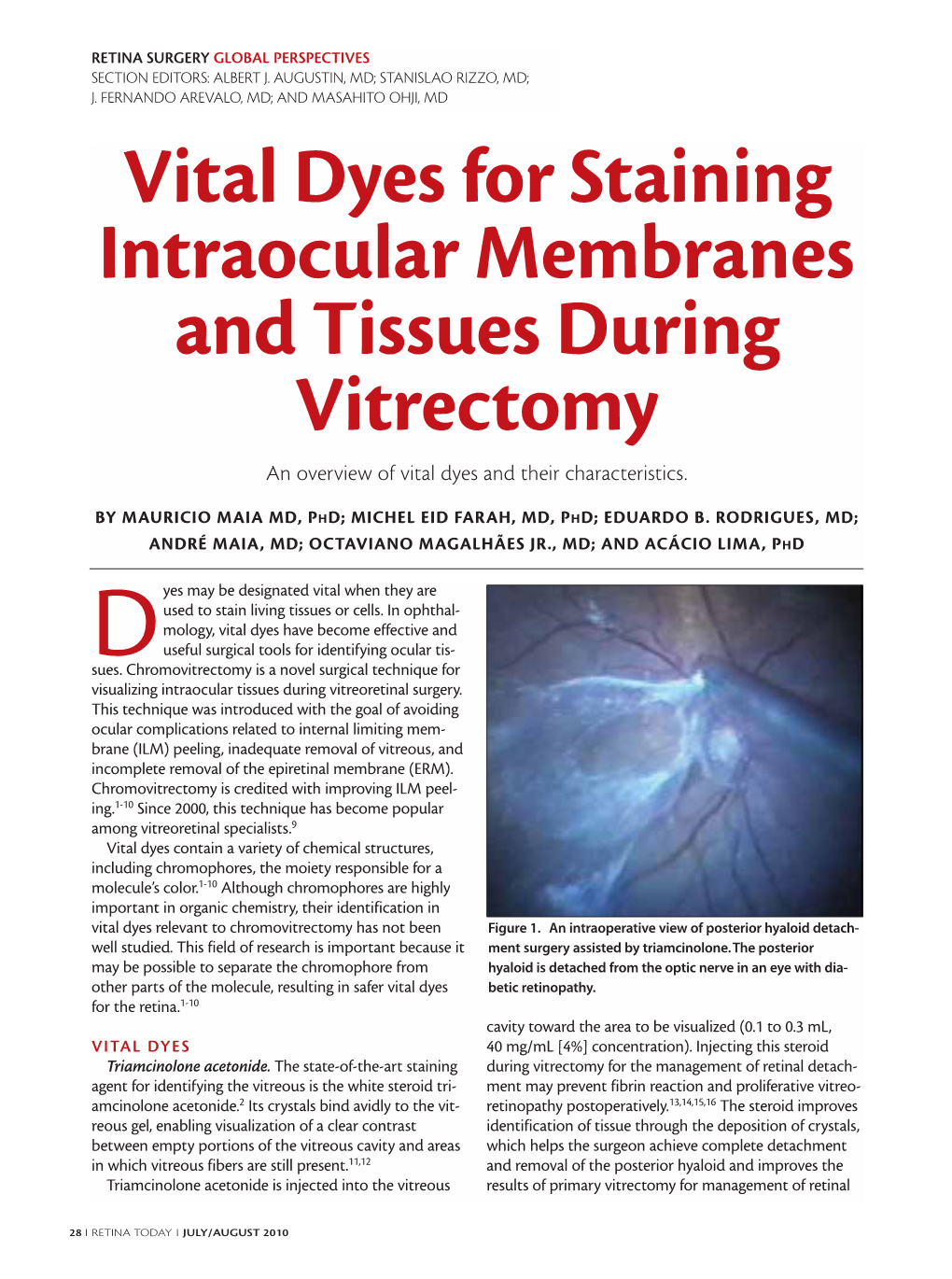 Vital Dyes for Staining Intraocular Membranes and Tissues During Vitrectomy an Overview of Vital Dyes and Their Characteristics