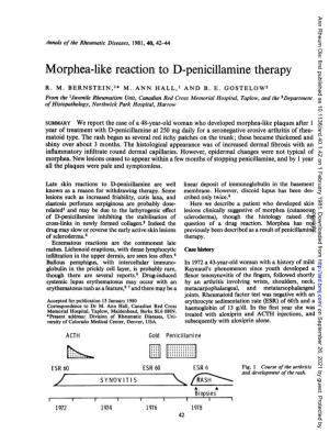 Morphea-Like Reaction to D-Penicillamine Therapy