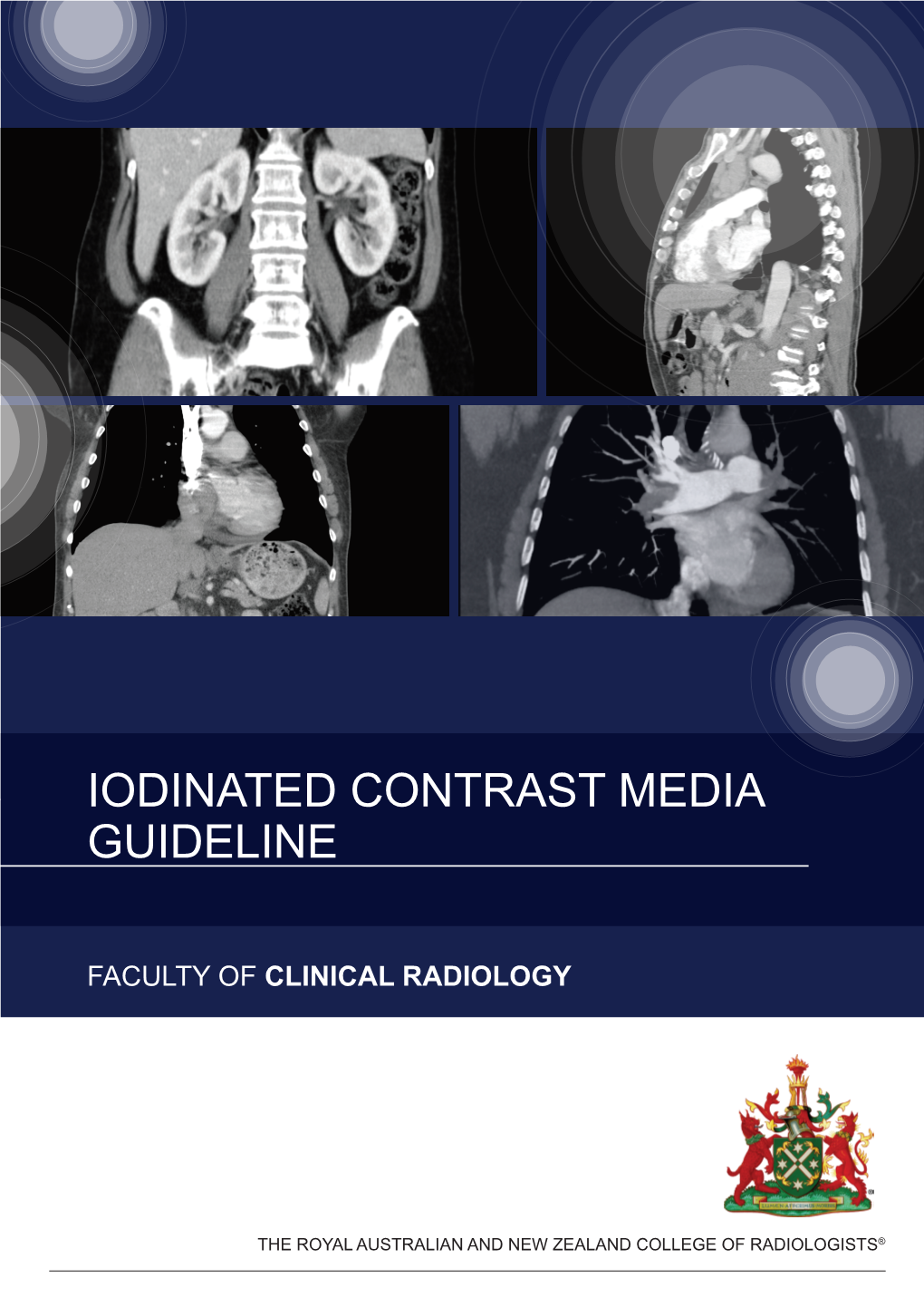 Iodinated Contrast Media Guideline