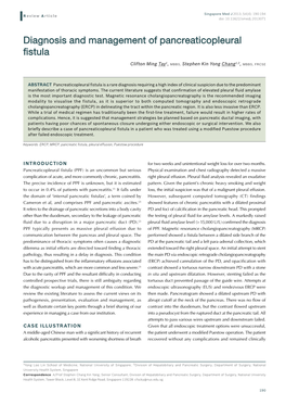 Diagnosis and Management of Pancreaticopleural Fistula