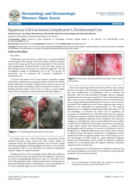 Squamous Cell Carcinoma Complicated a Trichilemmal Cyst