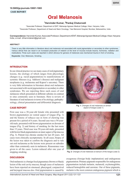 Oral Melanosis