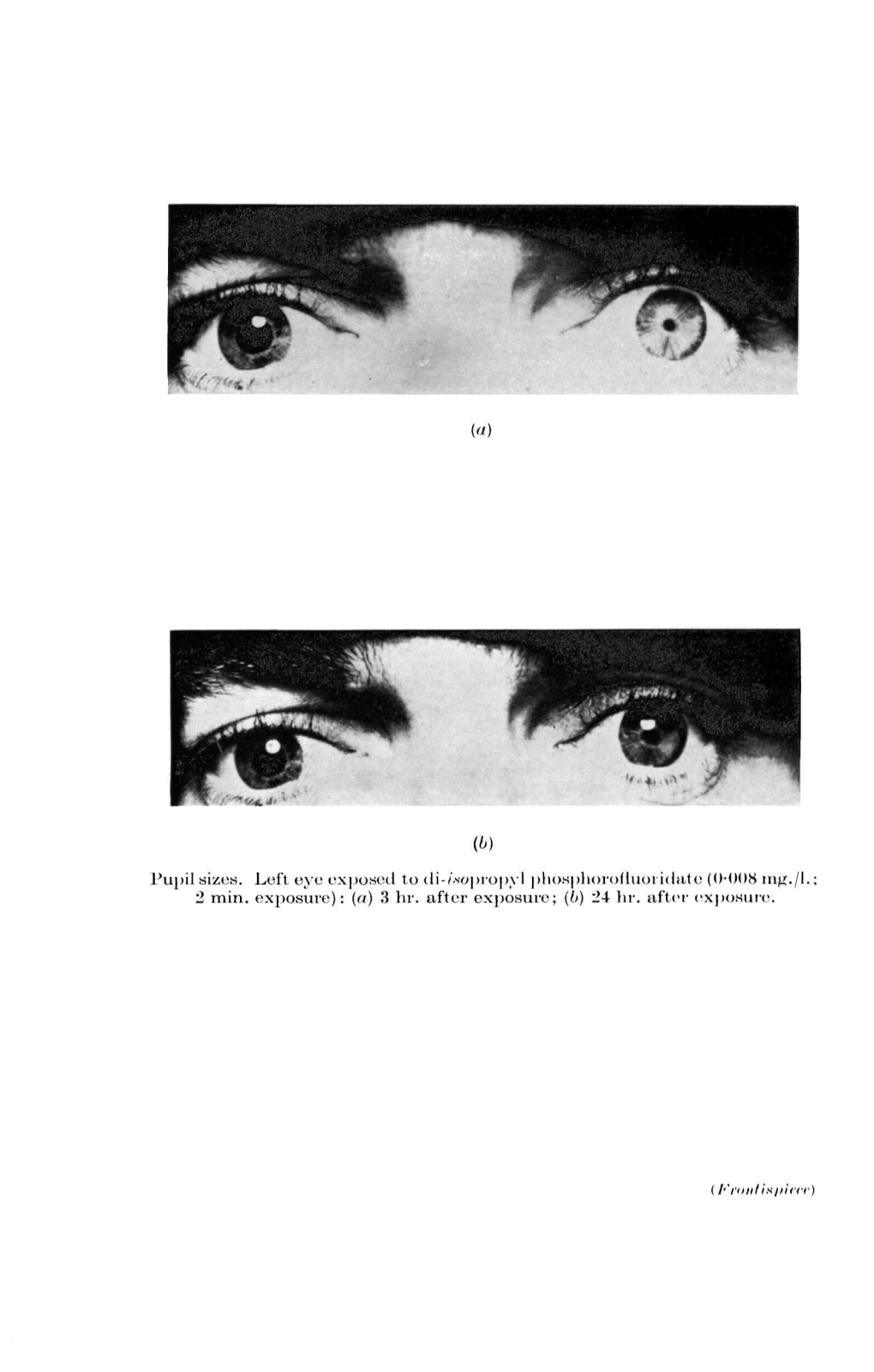 (A) Pupil Sizes. Left Eye Exposed to Di-/Wpropyl Phosphorofluoi Idate (0