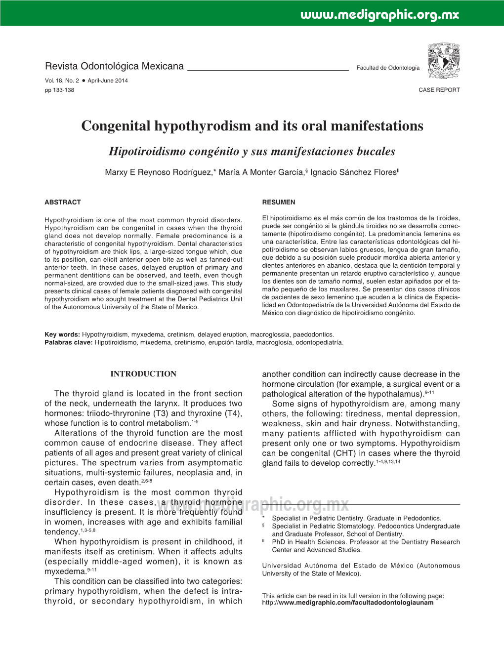 Congenital Hypothyrodism and Its Oral Manifestations Hipotiroidismo Congénito Y Sus Manifestaciones Bucales