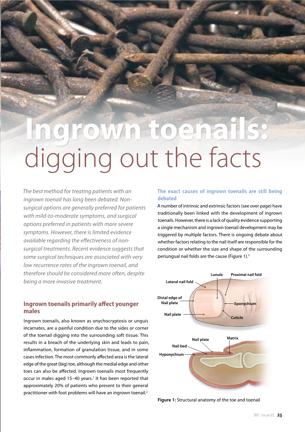 Ingrown Toenails: Digging out the Facts