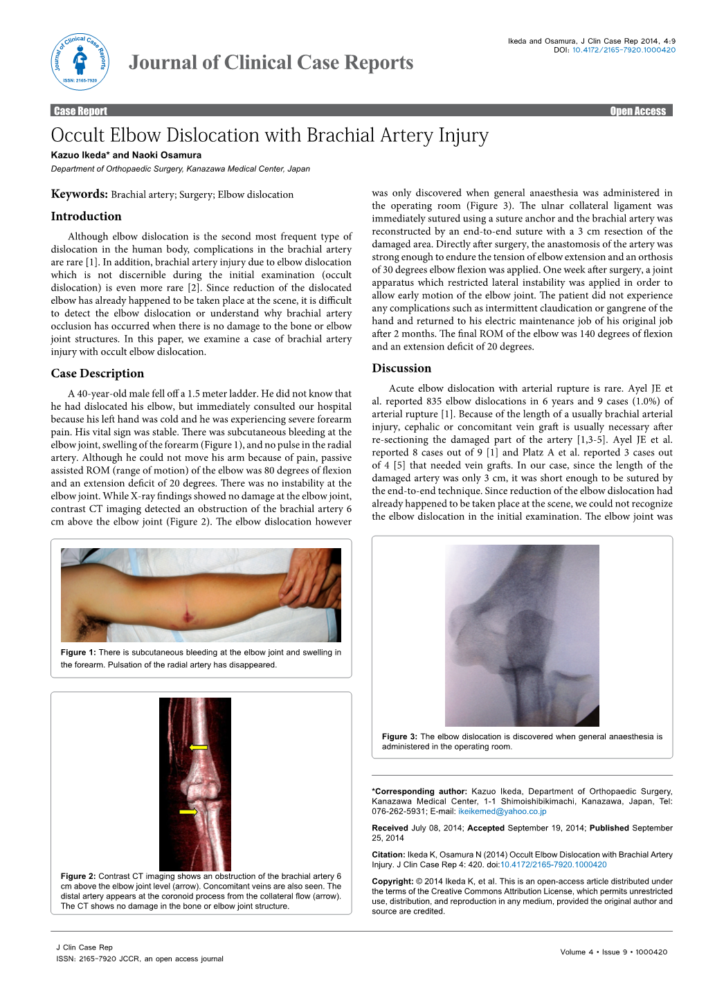 Occult Elbow Dislocation with Brachial Artery Injury Kazuo Ikeda* and Naoki Osamura Department of Orthopaedic Surgery, Kanazawa Medical Center, Japan