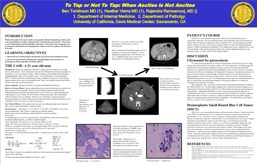 Ascites Is Not Ascites Ben Tomlinson MD (1), Heather Vierra MD (1), Rajendra Ramsamooj, MD () 1