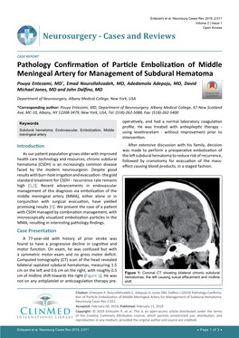 Pathology Confirmation of Particle Embolization of Middle Meningeal