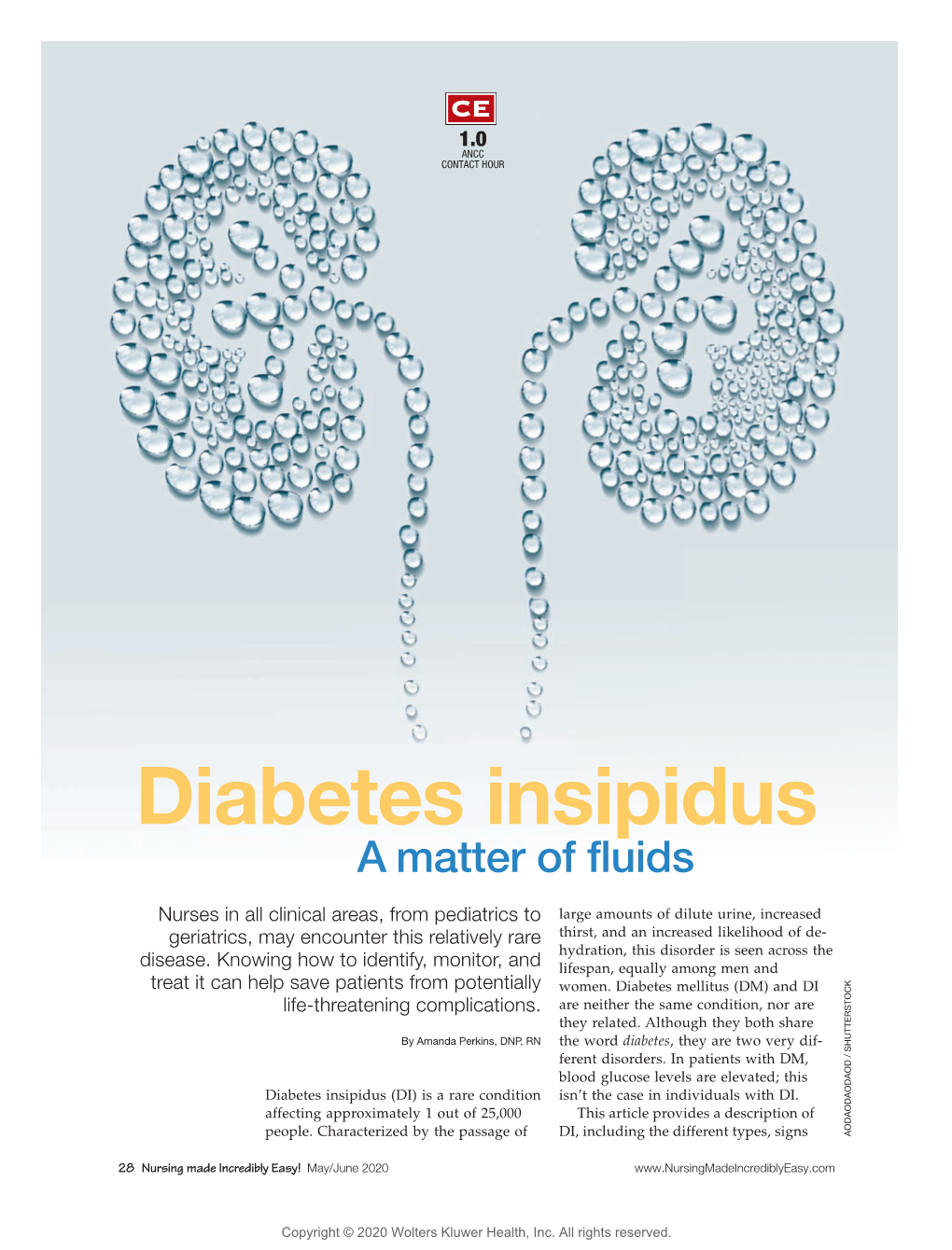 Diabetes Insipidus a Matter of Fluids