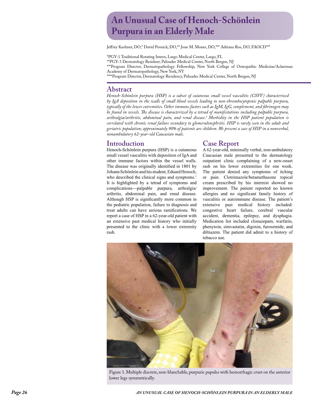 An Unusual Case of Henoch-Schönlein Purpura in an Elderly Male