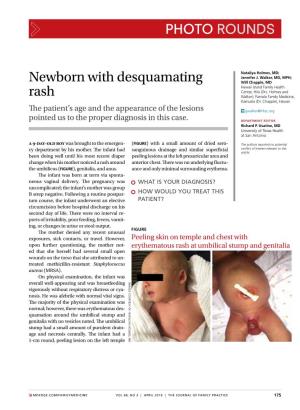 Newborn with Desquamating Rash