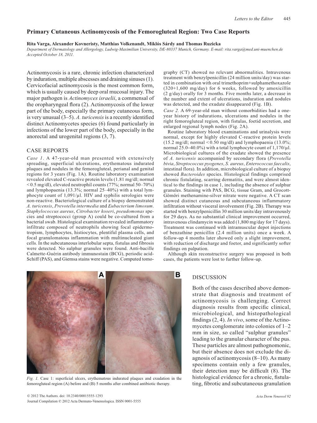 Primary Cutaneous Actinomycosis of the Femorogluteal Region: Two Case ...