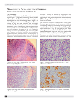 WOMAN with FACIAL and NECK SWELLING Meredith Chiaccio, MSIII and Donna Mscisz Williams, MD