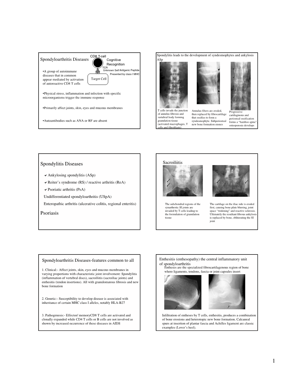 Spondylitis Diseases Psoriasis