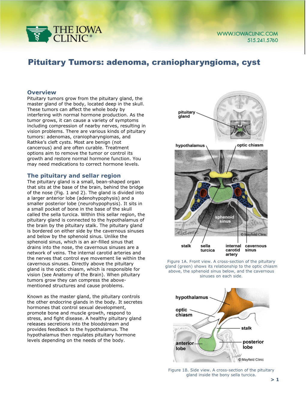 Pituitary Tumors: Adenoma, Craniopharyngioma, Cyst