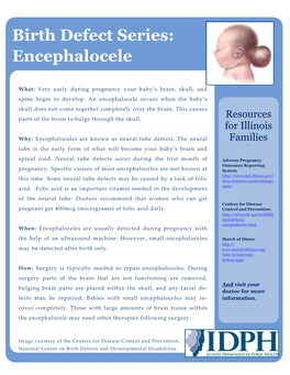 Birth Defect Series: Encephalocele