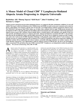 Progressing to Alopecia Universalis Lymphocyte-Mediated Alopecia