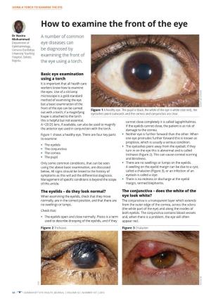 How to Examine the Front of the Eye