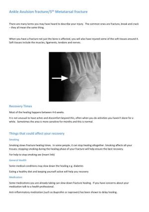 Ankle Avulsion Fracture/5Th Metatarsal Fracture