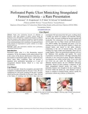 Perforated Peptic Ulcer Mimicking Strangulated Femoral Hernia – a Rare Presentation