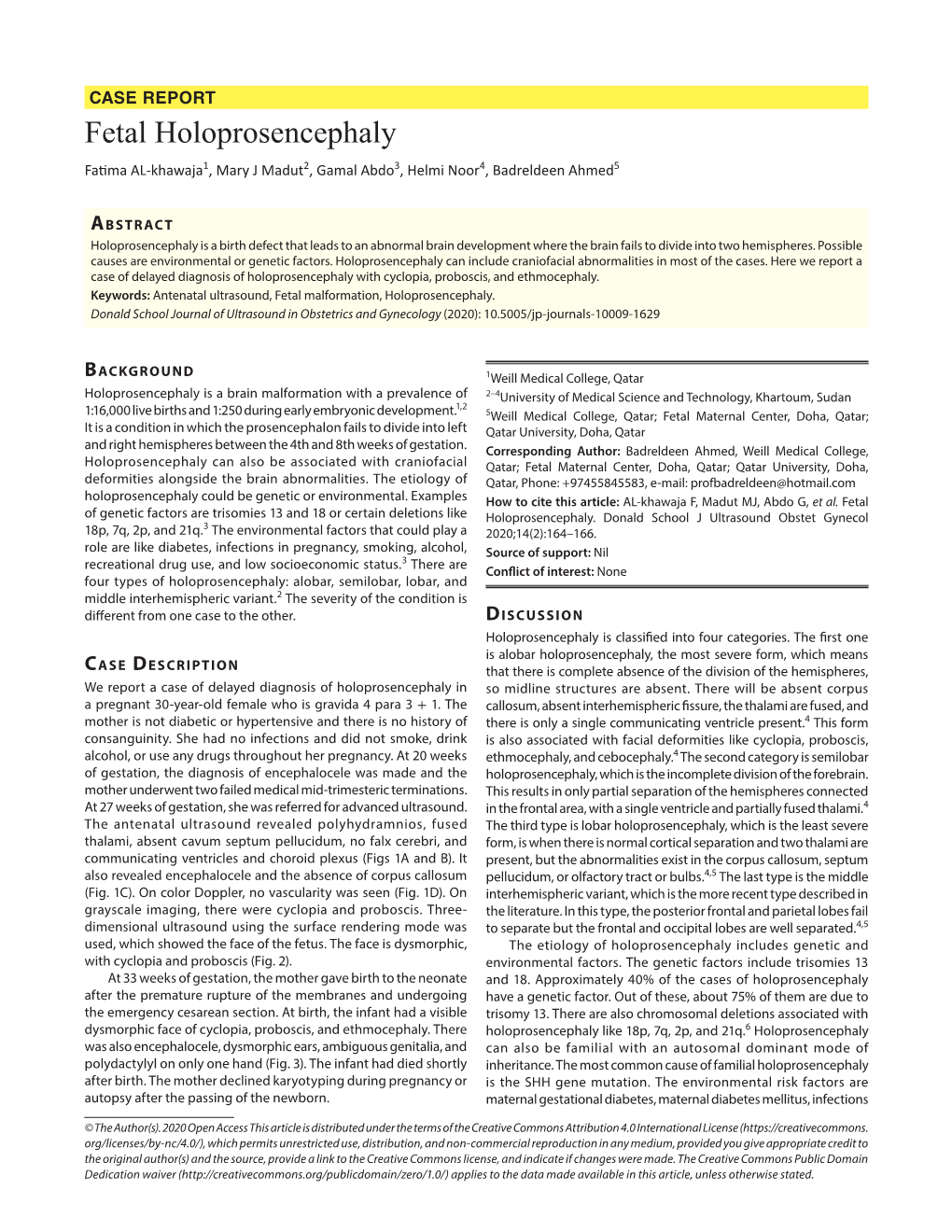 Fetal Holoprosencephaly Fatima AL-Khawaja1, Mary J Madut2, Gamal Abdo3, Helmi Noor4, Badreldeen Ahmed5