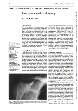 Progressive Shoulder Arthropathy Ann Rheum Dis: First Published As 10.1136/Ard.54.3.168 on 1 March 1995