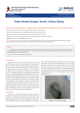 Pubo-Penile Ectopic Testis: a Rare Entity