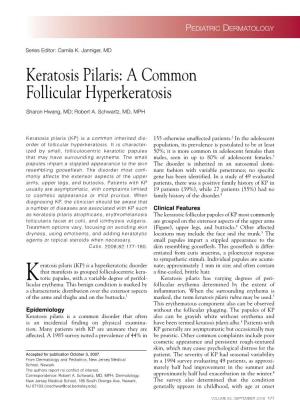 Keratosis Pilaris: a Common Follicular Hyperkeratosis
