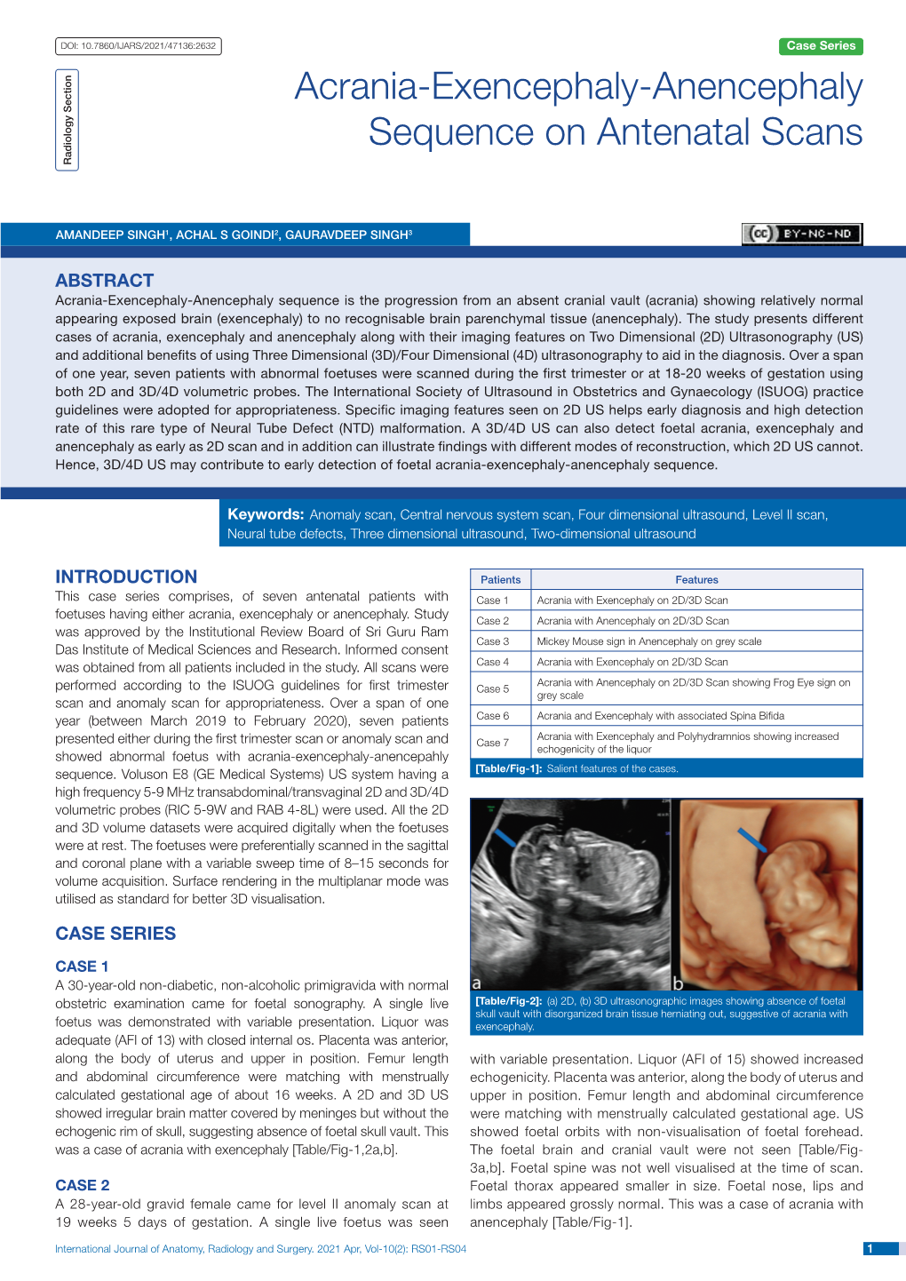 Acrania-Exencephaly-Anencephaly Sequence on Antenatal Scans Radiology Section