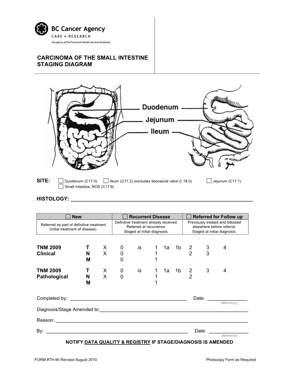 Carcinoma of the Small Intestine Staging Diagram