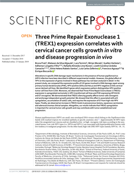 Three Prime Repair Exonuclease 1 (TREX1) Expression Correlates with Cervical Cancer Cells Growth in Vitro and Disease Progressio