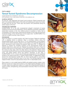 Tarsal Tunnel Syndrome Decompression CASE REPORT by THOMAS H