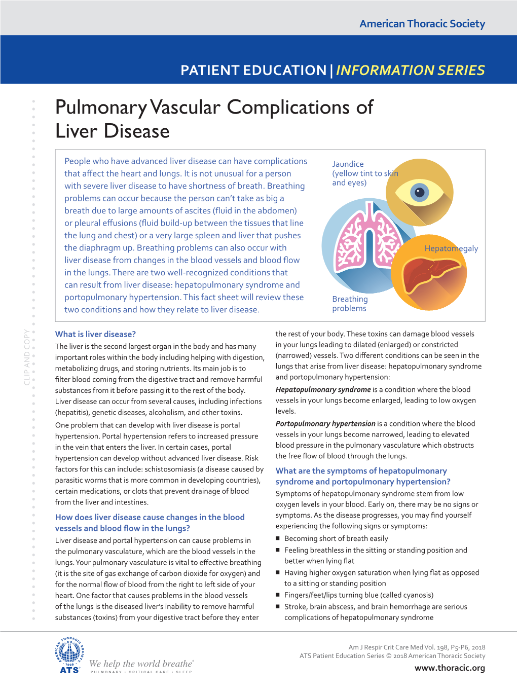 Pulmonary Vascular Complications of Liver Disease