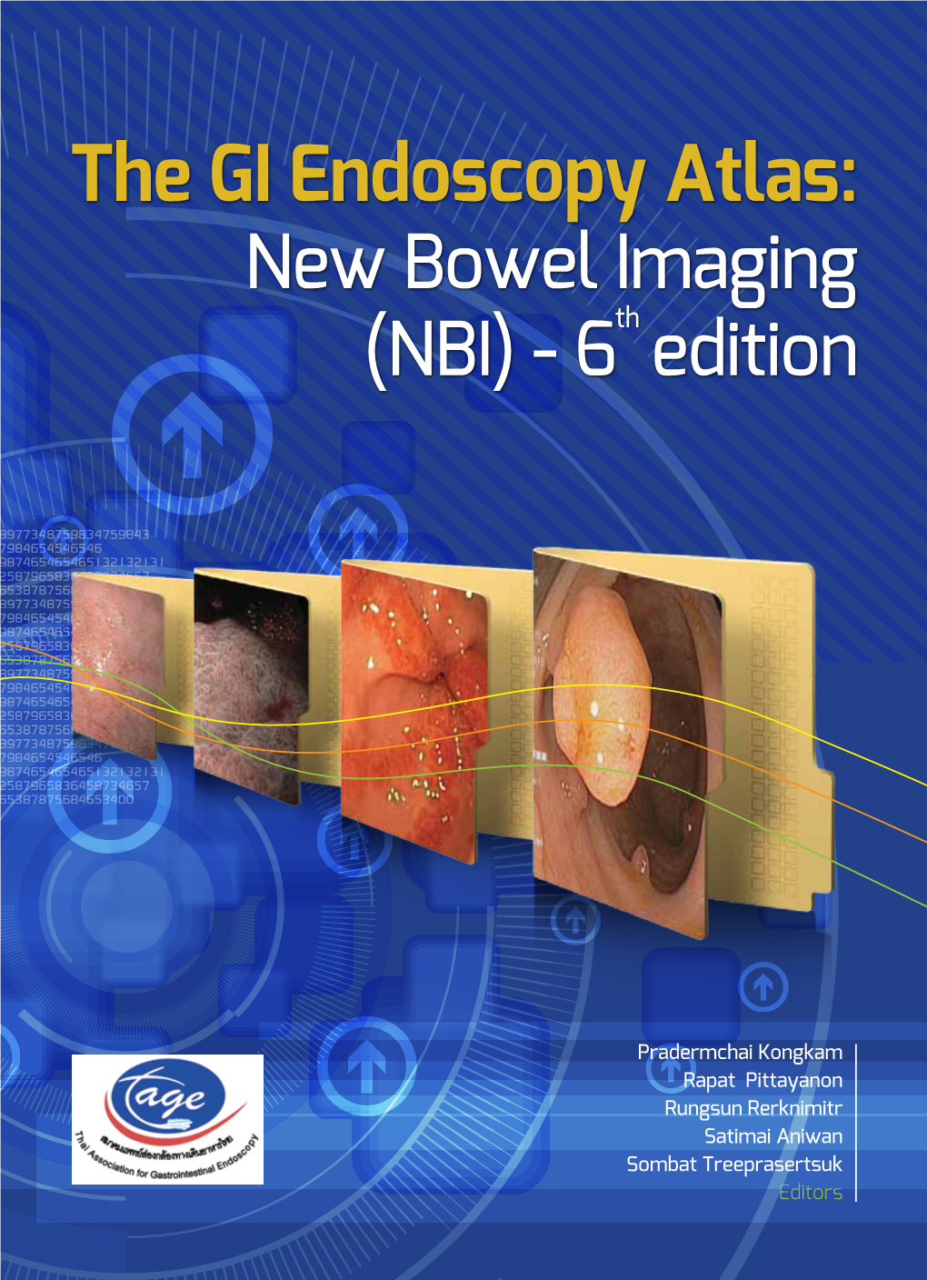 The GI Endoscopy Atlas: New Bowel Imageing (NBI)-6Th Edition the GI Endoscopy Atlas: New Bowel Imageing (NBI)-6Th Edition