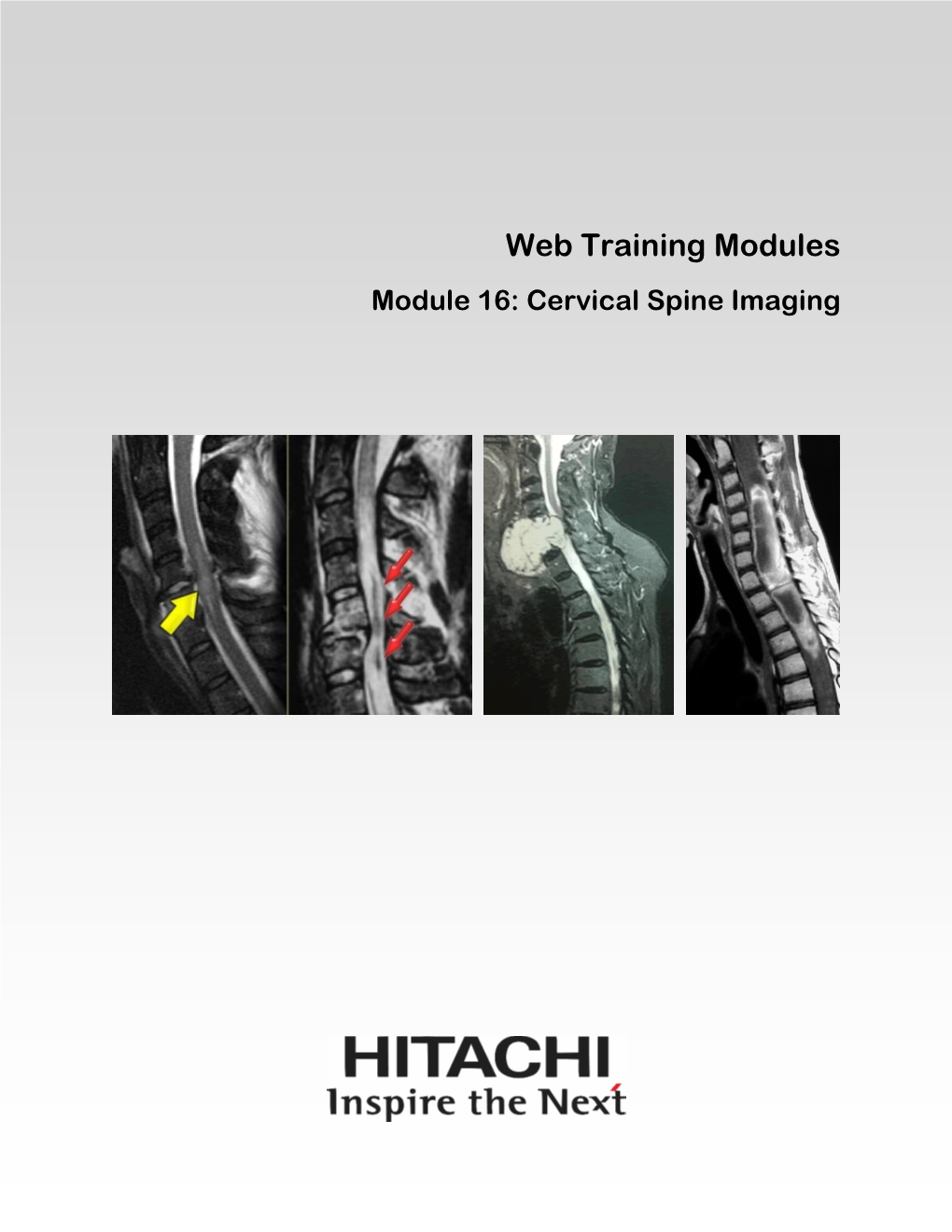 Web Training Modules Module 16: Cervical Spine Imaging Web Training Modules | Module 16: Cervical Spine Imaging